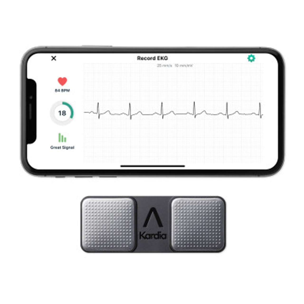 Appareil ECG AliveCor KardiaMobile à deux électrodes et son tracé à une dérivation sur un smartphone