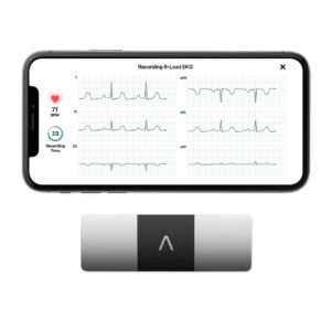 AliveCor KardiaMobile 6L